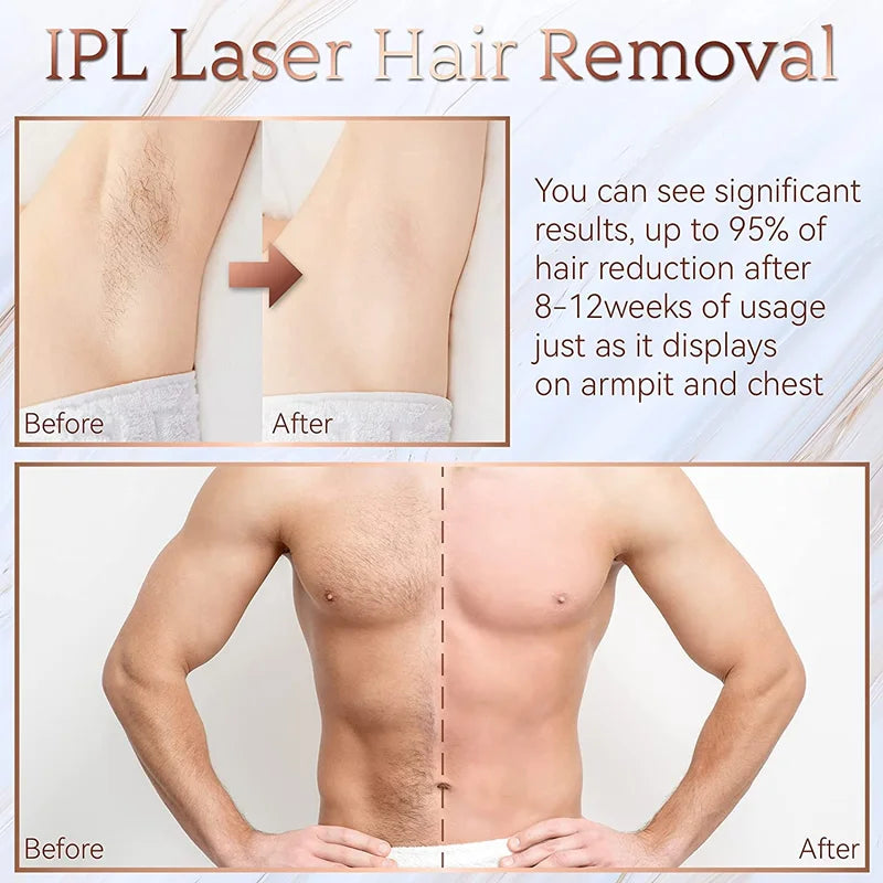 Lumi IPL Laser Epilator Hair Removal