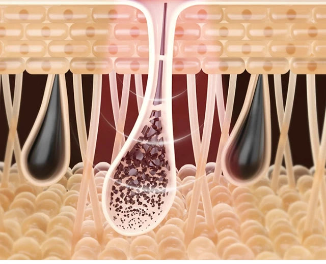 Lumi IPL Laser Epilator Hair Removal