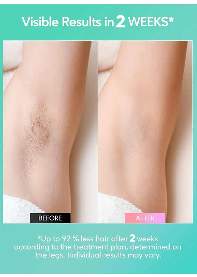 Lumi IPL Laser Epilator Hair Removal