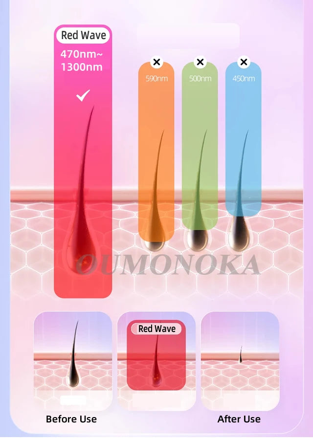 Lumi IPL Laser Epilator Hair Removal