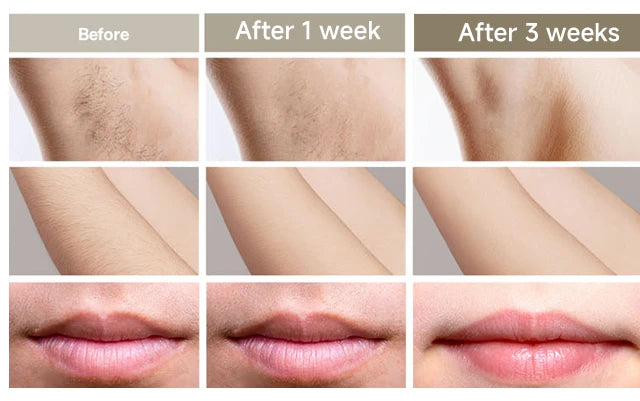 Lumi IPL Laser Epilator Hair Removal